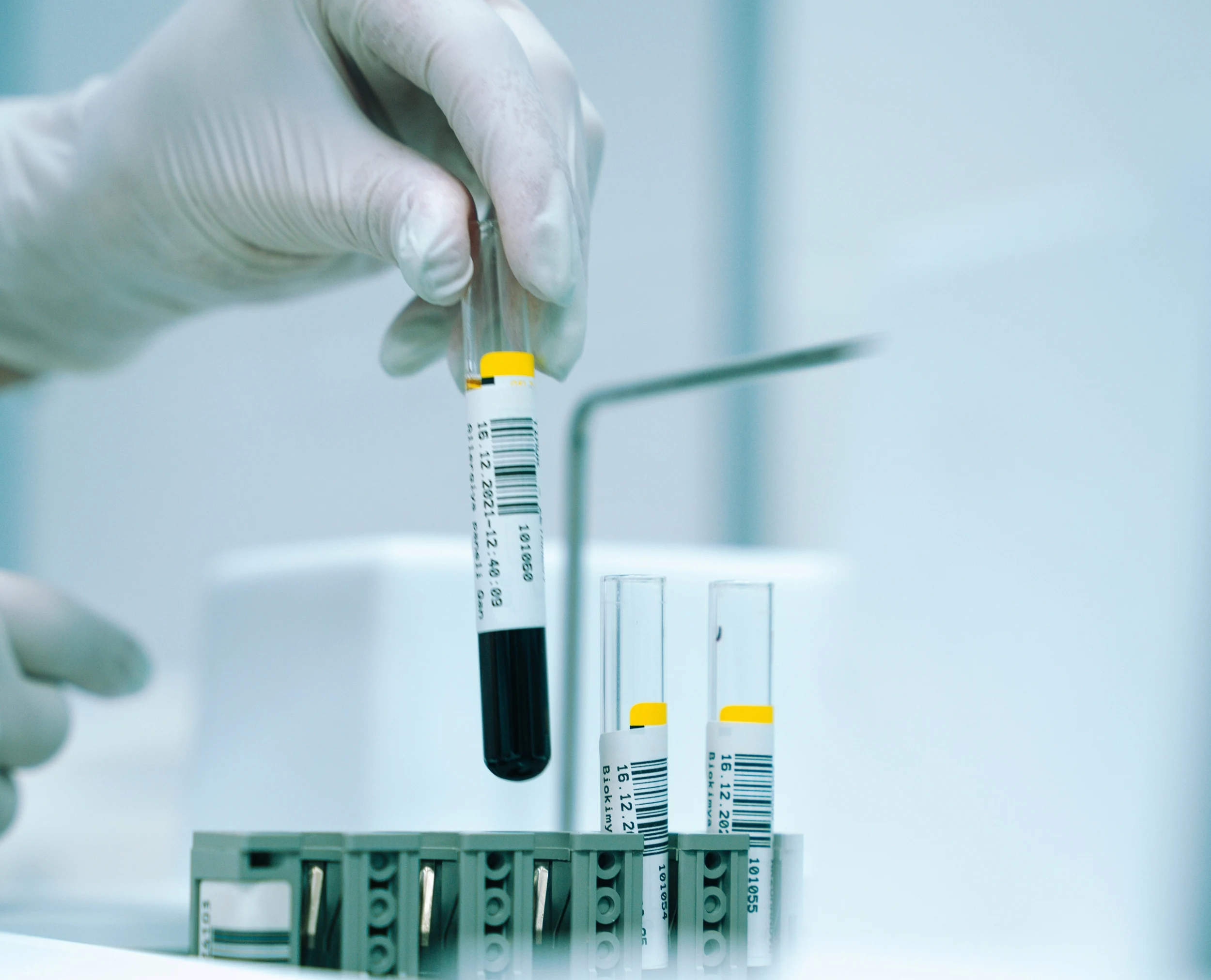 A blood sample tube being placed in a rack